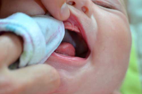 newborn oral care